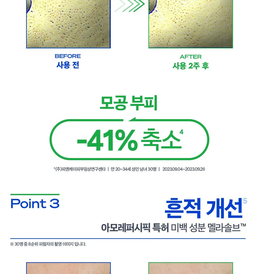 [트러블 진정+모공 축소] 비레디 시카페인 트러블 리셋 세럼 상세페이지 20